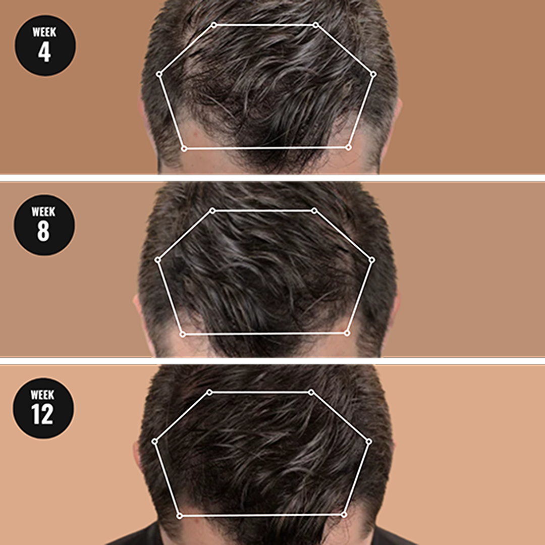 Root Activator Shampoo