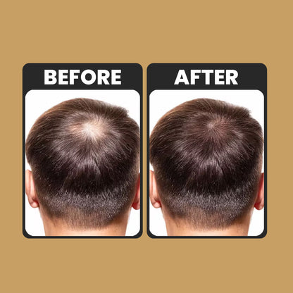 Root Activator Conditioner