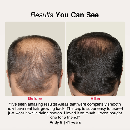 Red Light Growth Cap